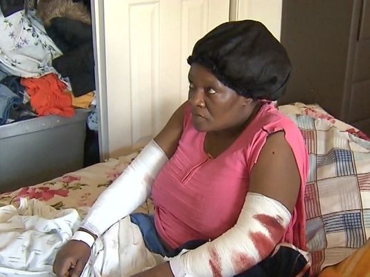 Woman-rescued-from-vicious-pit-bull-attack-on-her-and-five-others-in-Neptune-City-NJ-on-March-22-2017-COURTESY-OF-NEWS12